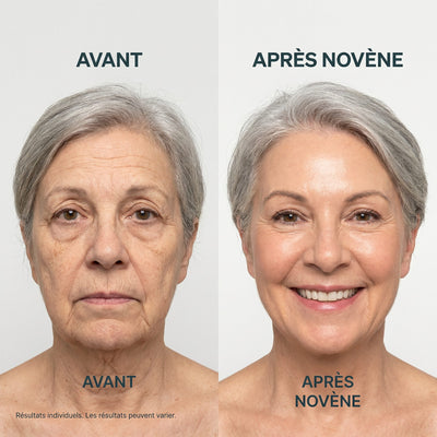 Kit Micro-Infusion™ | Novène