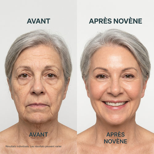 Kit Micro-Infusion™ | Novène