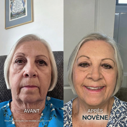 Kit Micro-Infusion™ | Novène