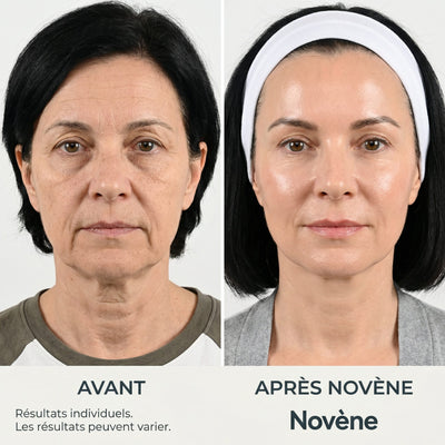 Kit Micro-Infusion™ | Novène