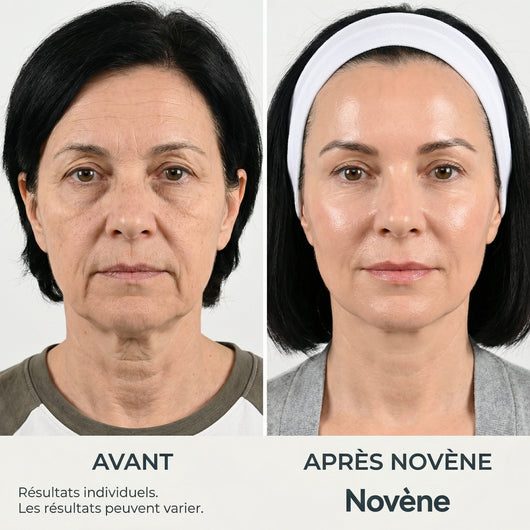 Kit Micro-Infusion™ | Novène