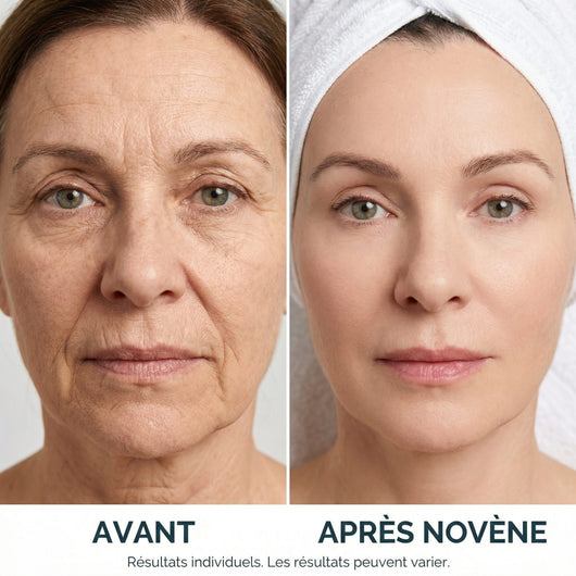 Kit Micro-Infusion™ | Novène