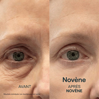 Kit Micro-Infusion™ | Novène