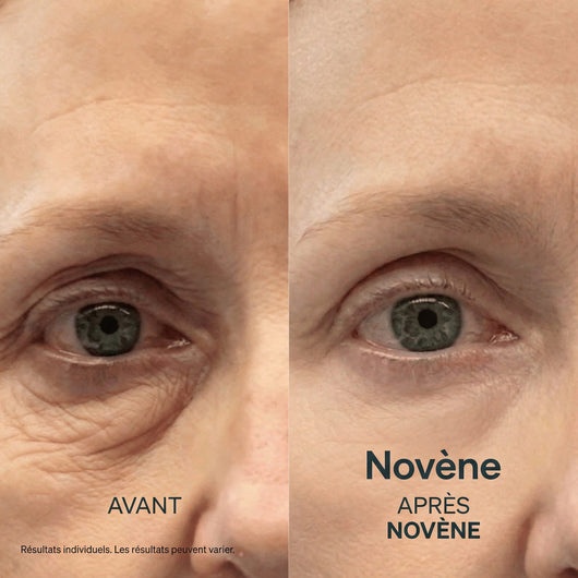 Kit Micro-Infusion™ | Novène