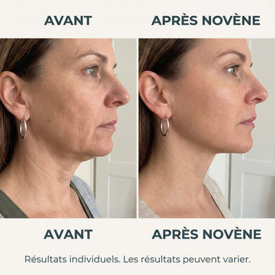 Kit Micro-Infusion™ | Novène