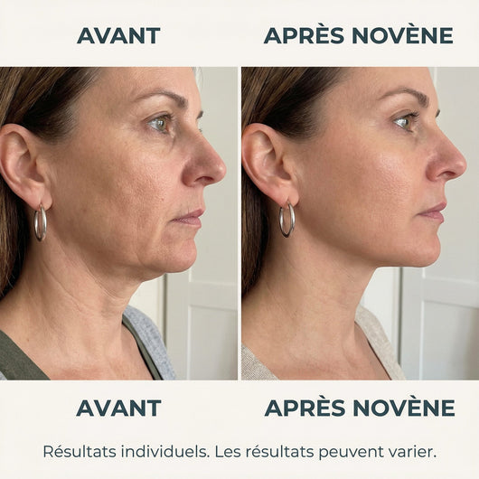 Kit Micro-Infusion™ | Novène