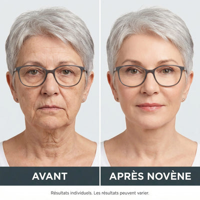 Kit Micro-Infusion™ | Novène